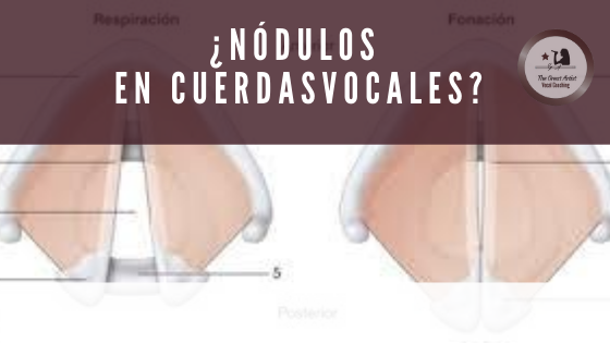 Nódulos en cuerdas vocales , causas y sintomas